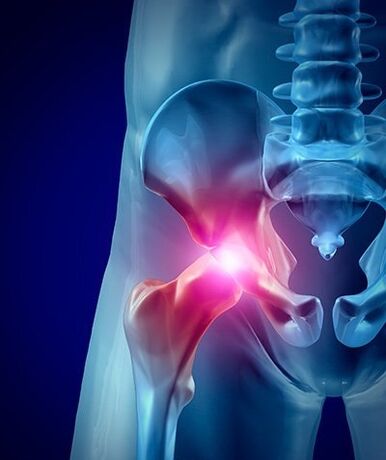 dor de cadeira foto 1